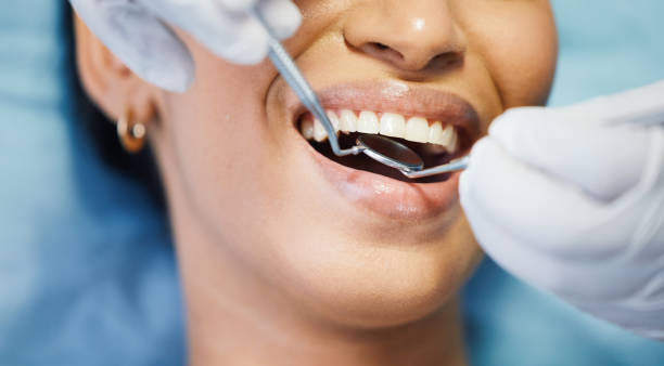 Best Urgent Care for Lost Fillings or Crowns in Tipton, IN
